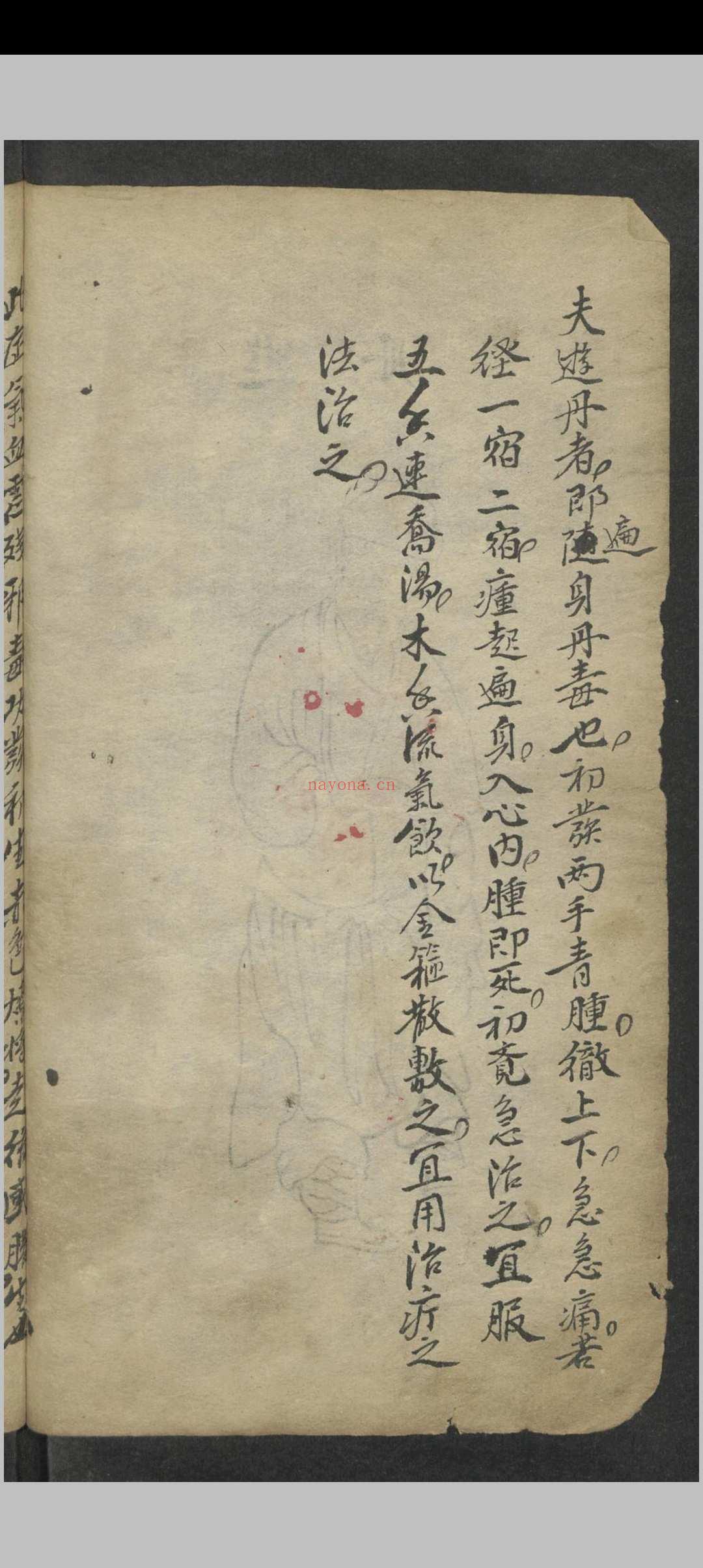 窦杰 窦杰 窦太师疮疡经验全书