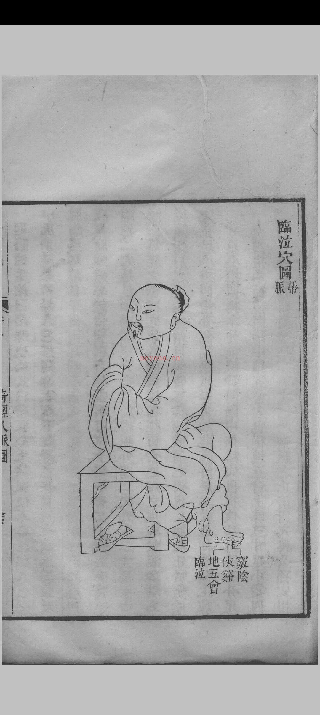 医钞类编(24卷)