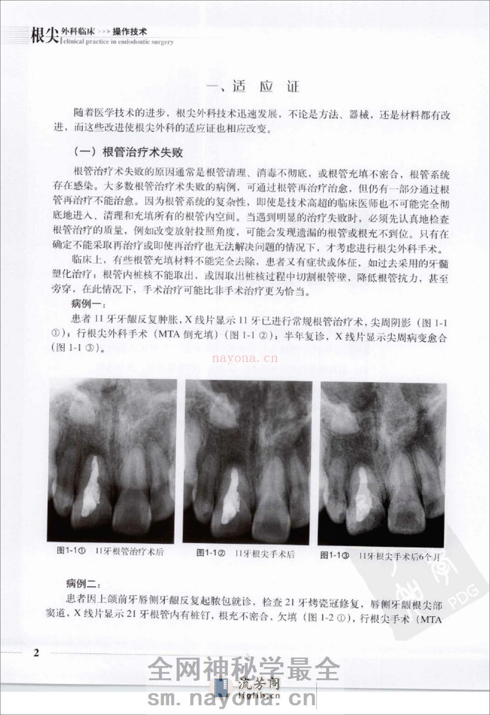 根尖外科临床操作技术_12625986 - 第10页预览图