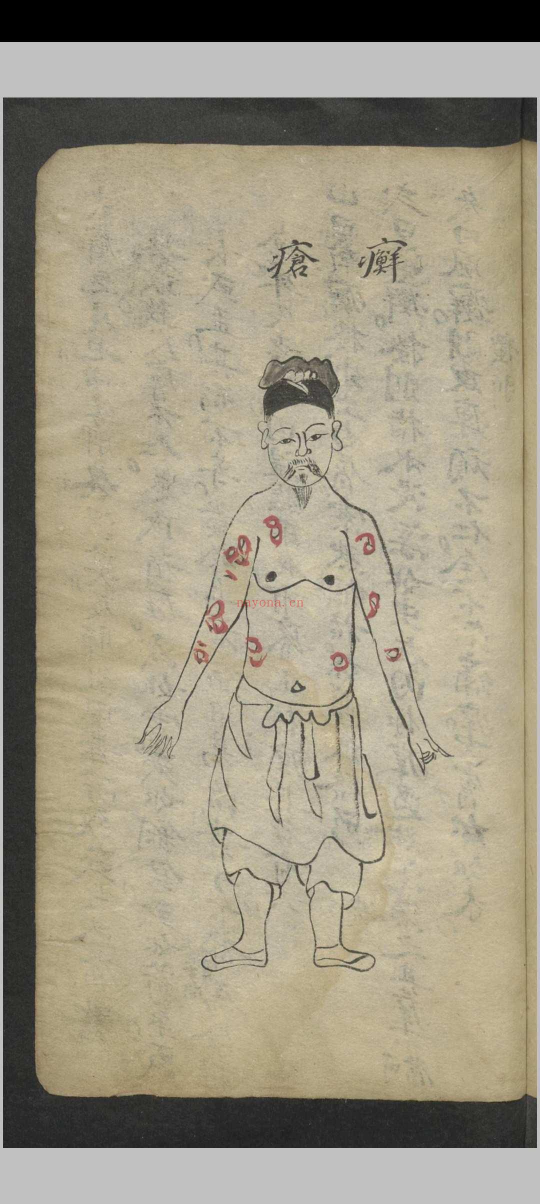 窦杰 窦杰 窦太师疮疡经验全书