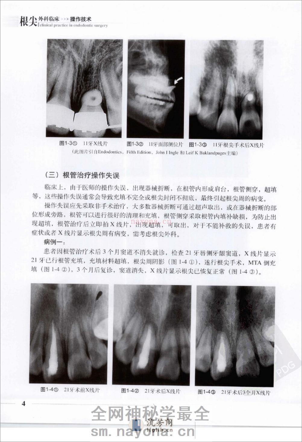 根尖外科临床操作技术_12625986 - 第12页预览图