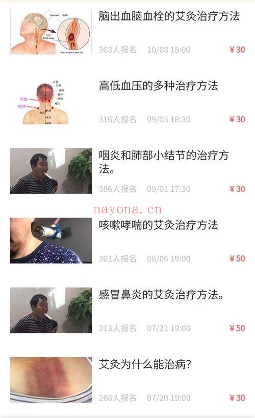 中医大师单桂敏《艾灸治疗常见病》29集视频