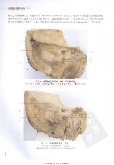 颞骨断层解剖与CT.pdf