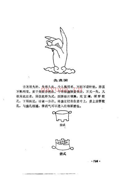 代中医珍本集灸法秘传.pdf