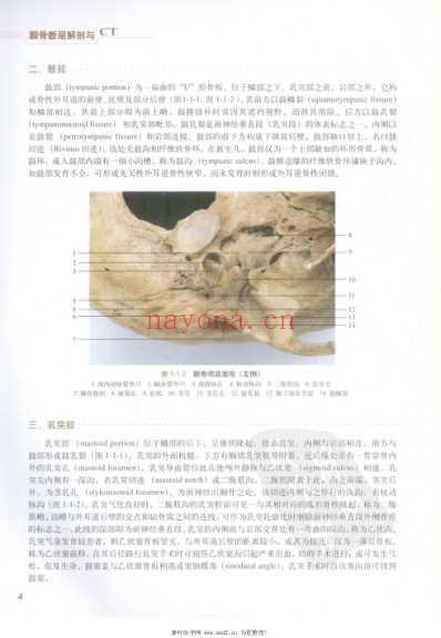 颞骨断层解剖与CT.pdf