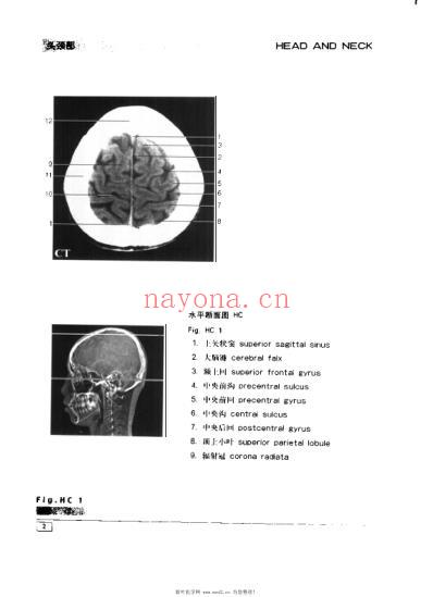 CT与MRI影像解剖学图谱.pdf