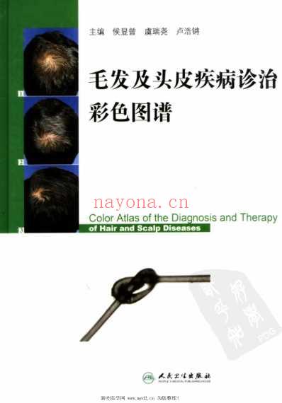 毛发及头皮疾病诊治彩色图谱.pdf