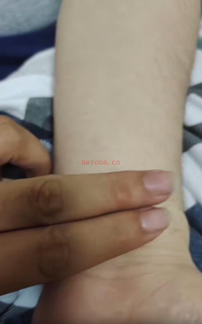 一浩摸脉22集;百度网盘