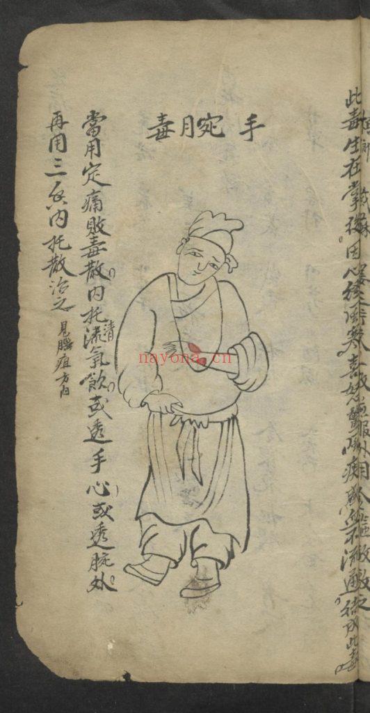 《窦太师疮疡经验全书》10