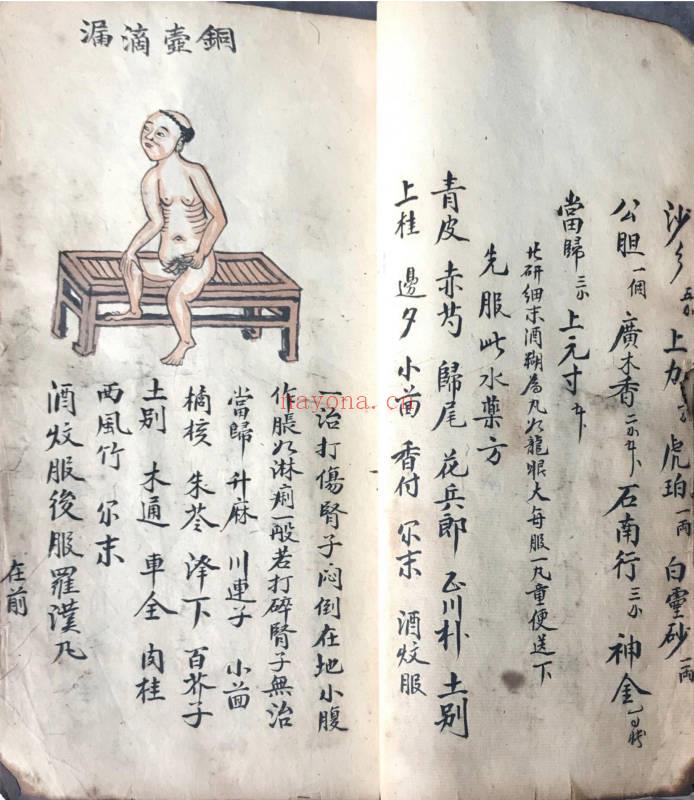 《跌打损伤108穴秘方》正宗武师祖传抄本 230单页.PDF电子版