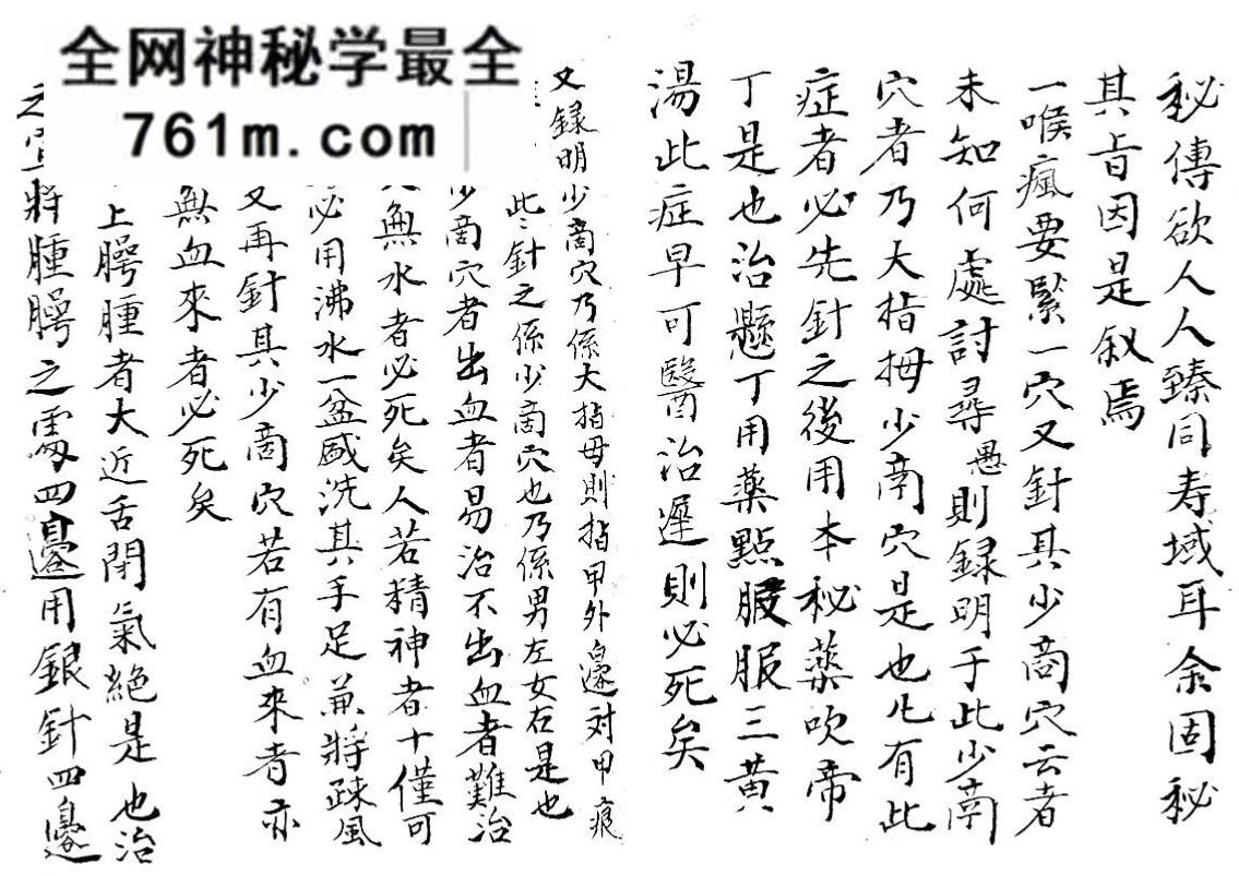 中医古籍《咽喉秘传》