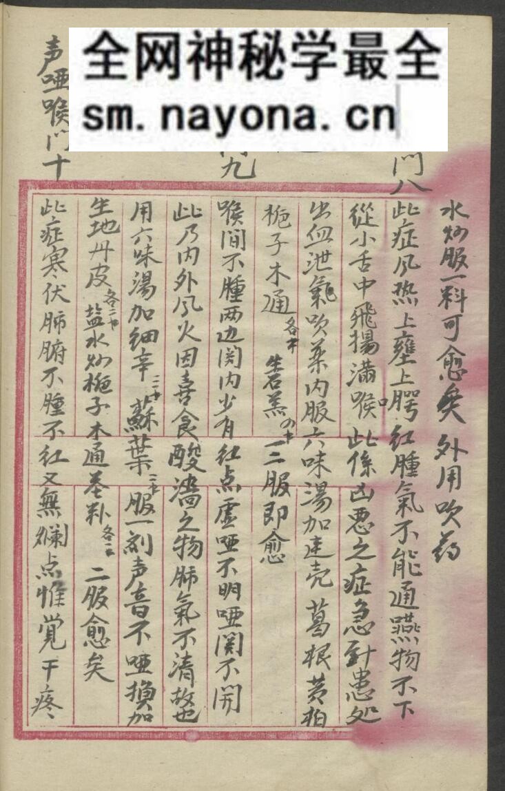 中医喉科古籍《喉科指掌大全》张宗良