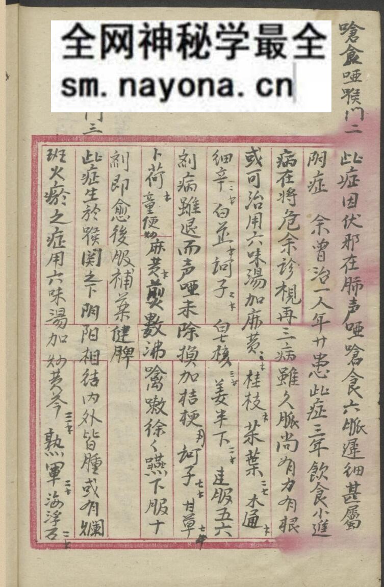 中医喉科古籍《喉科指掌大全》张宗良