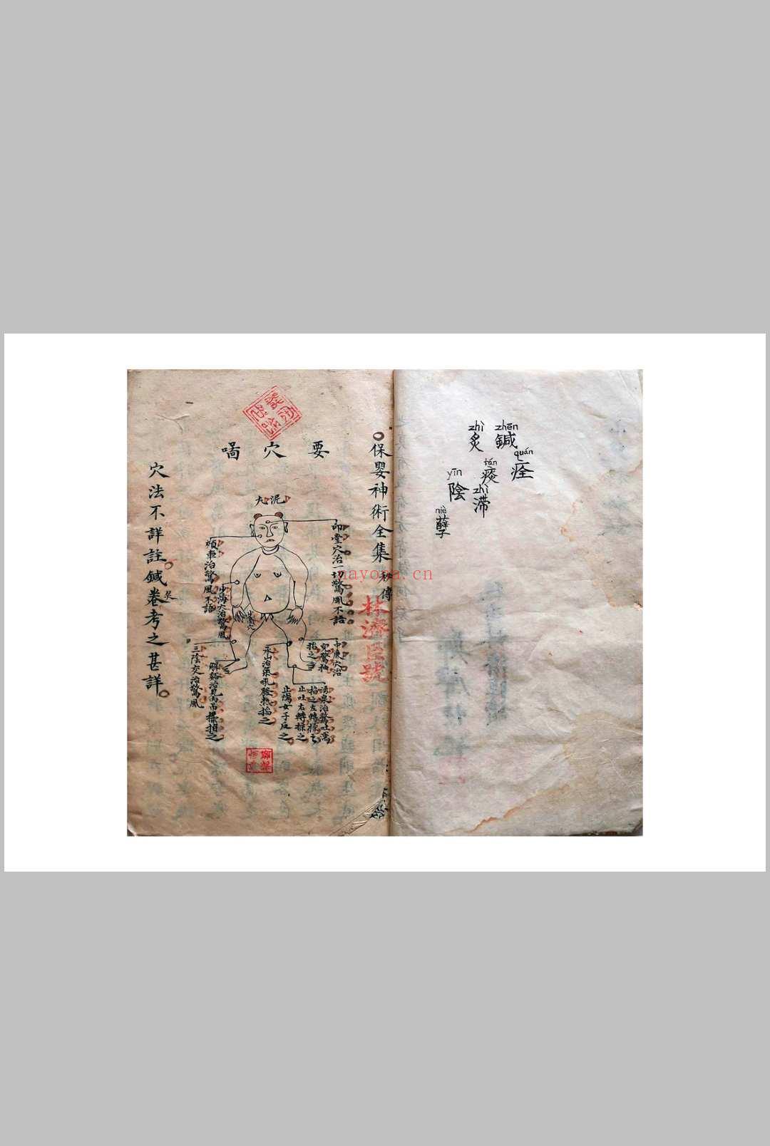 《祖传小儿科神火经纹秘诀》