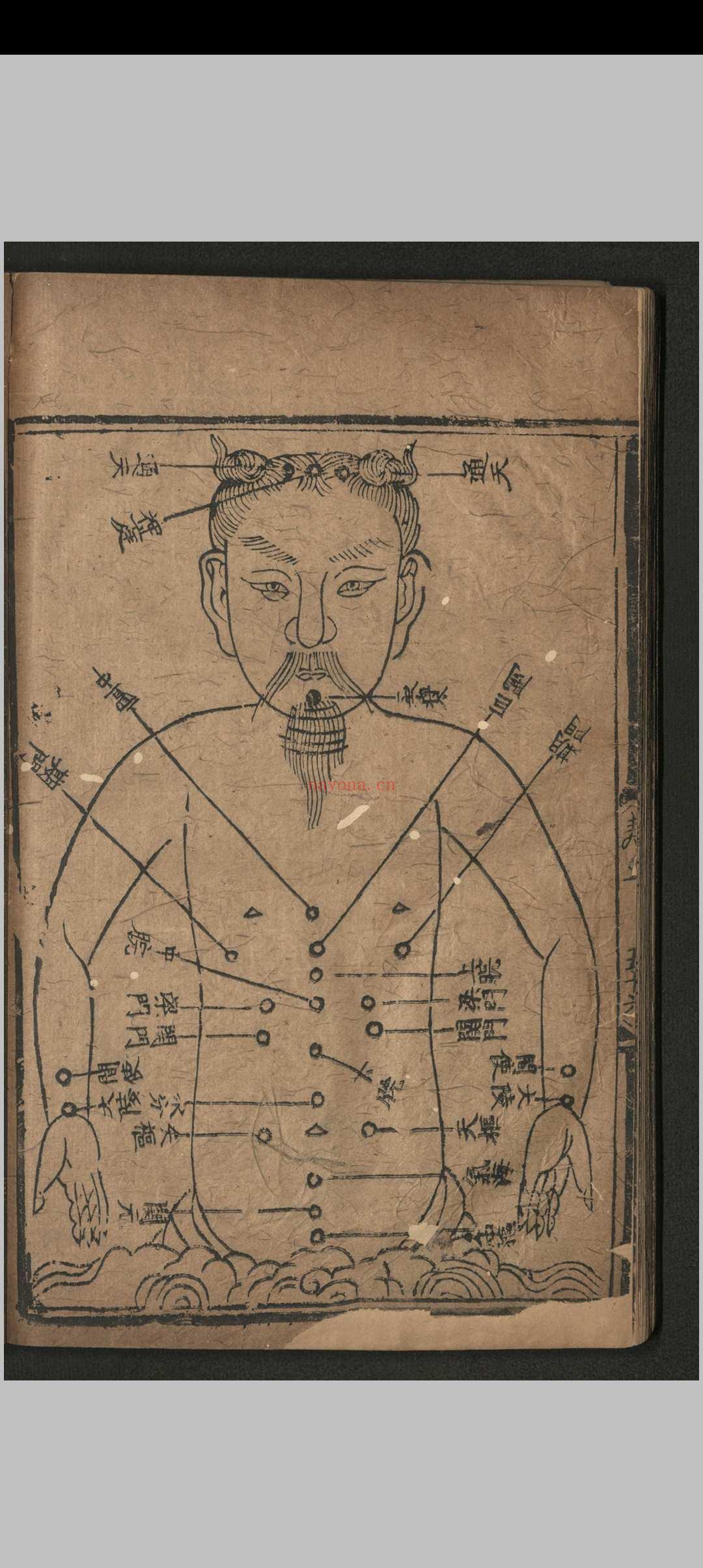 寿域神方.四卷 欠1-2卷.朱权