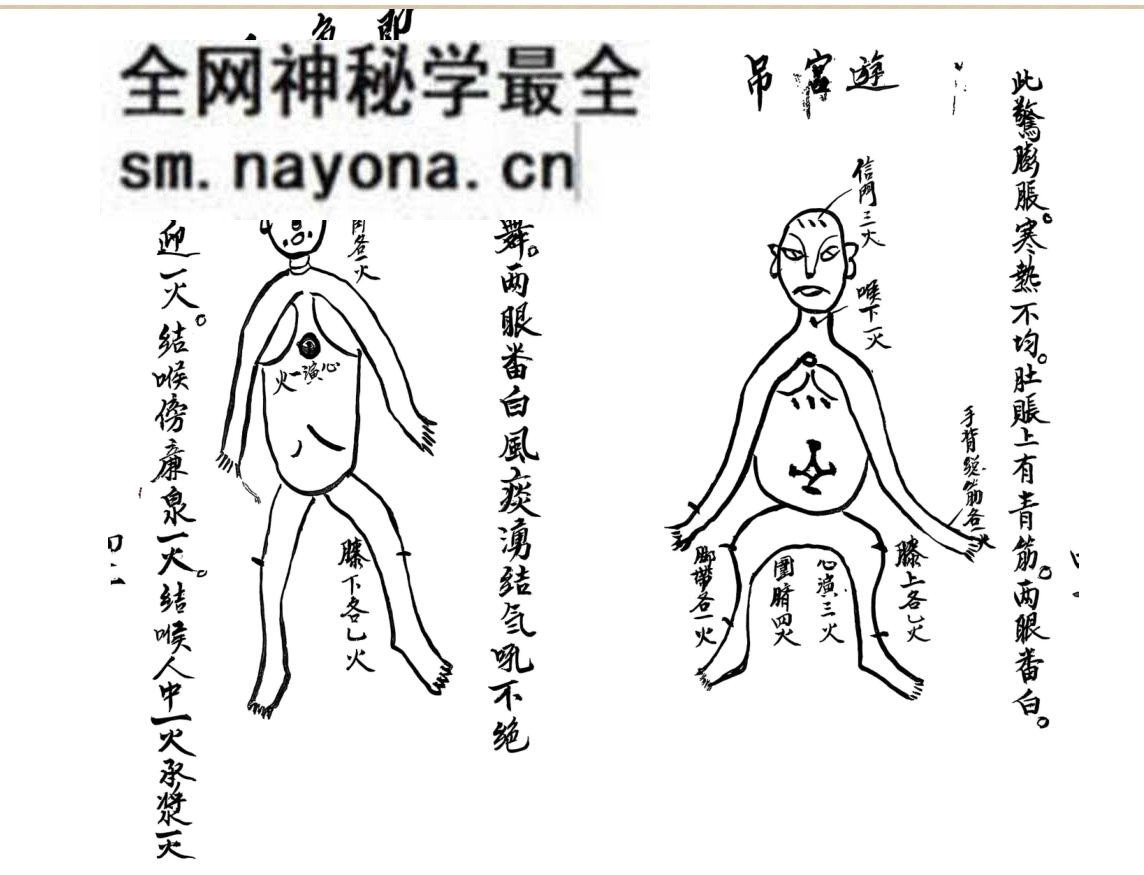 中医针灸推拿古籍《家传宝书按摩推拿针灸图》