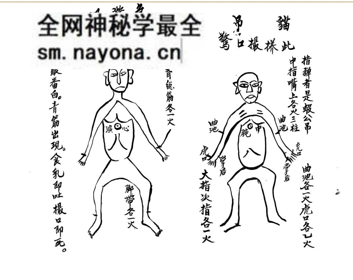 中医针灸推拿古籍《家传宝书按摩推拿针灸图》