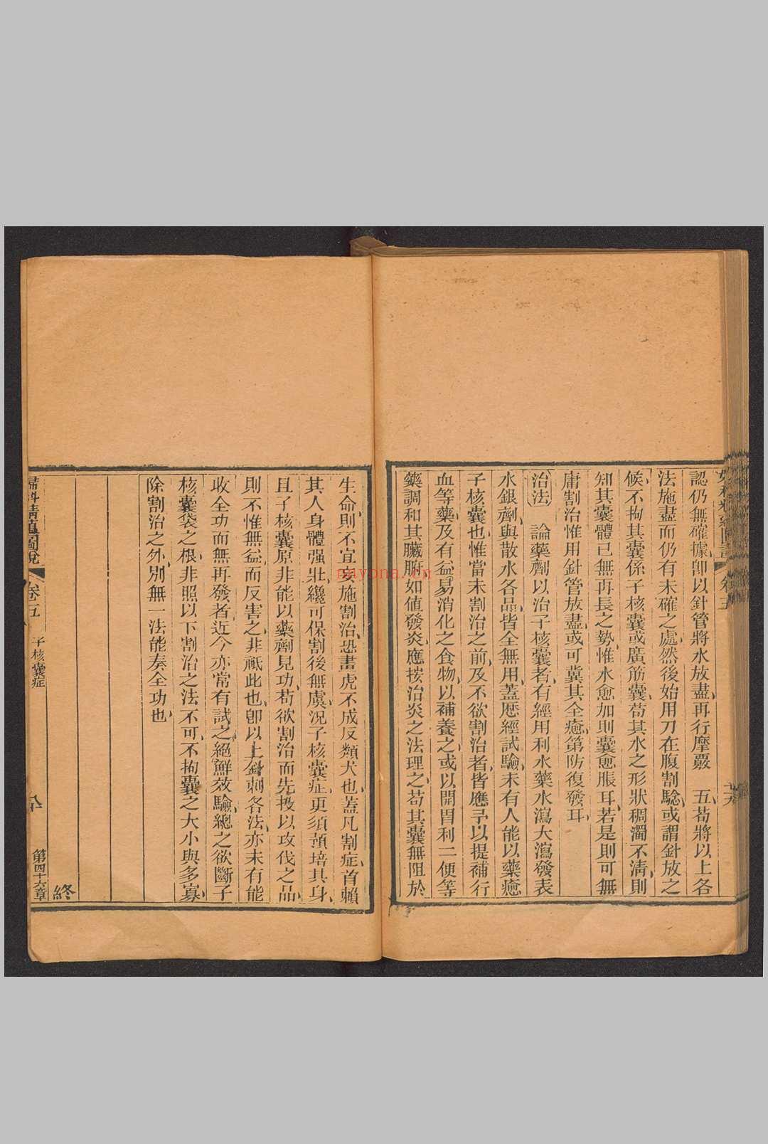 妇科精蕴图说 5卷 光绪15年(1889)羊城博济医局藏版