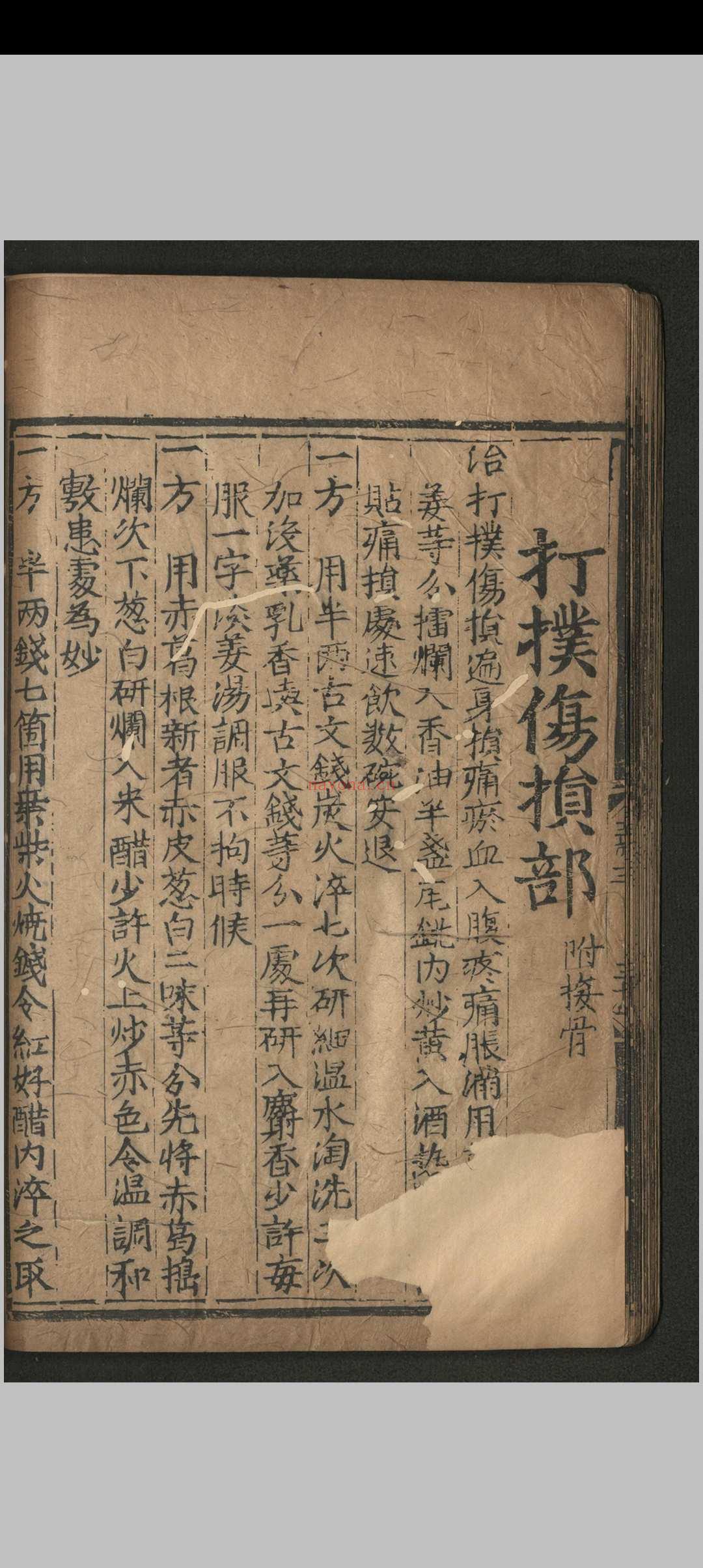 寿域神方.四卷 欠1-2卷.朱权