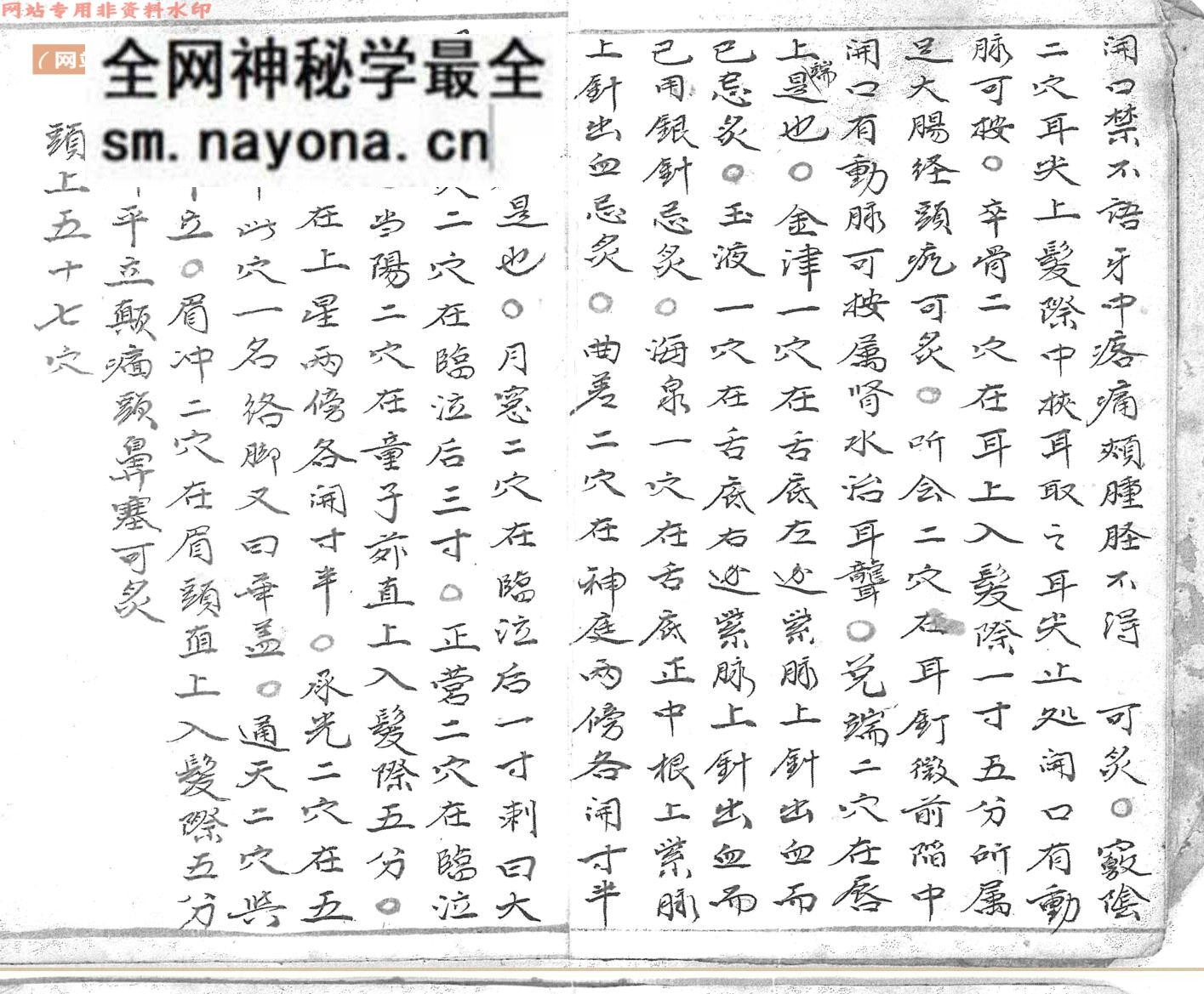 针灸古籍《火图穴法》