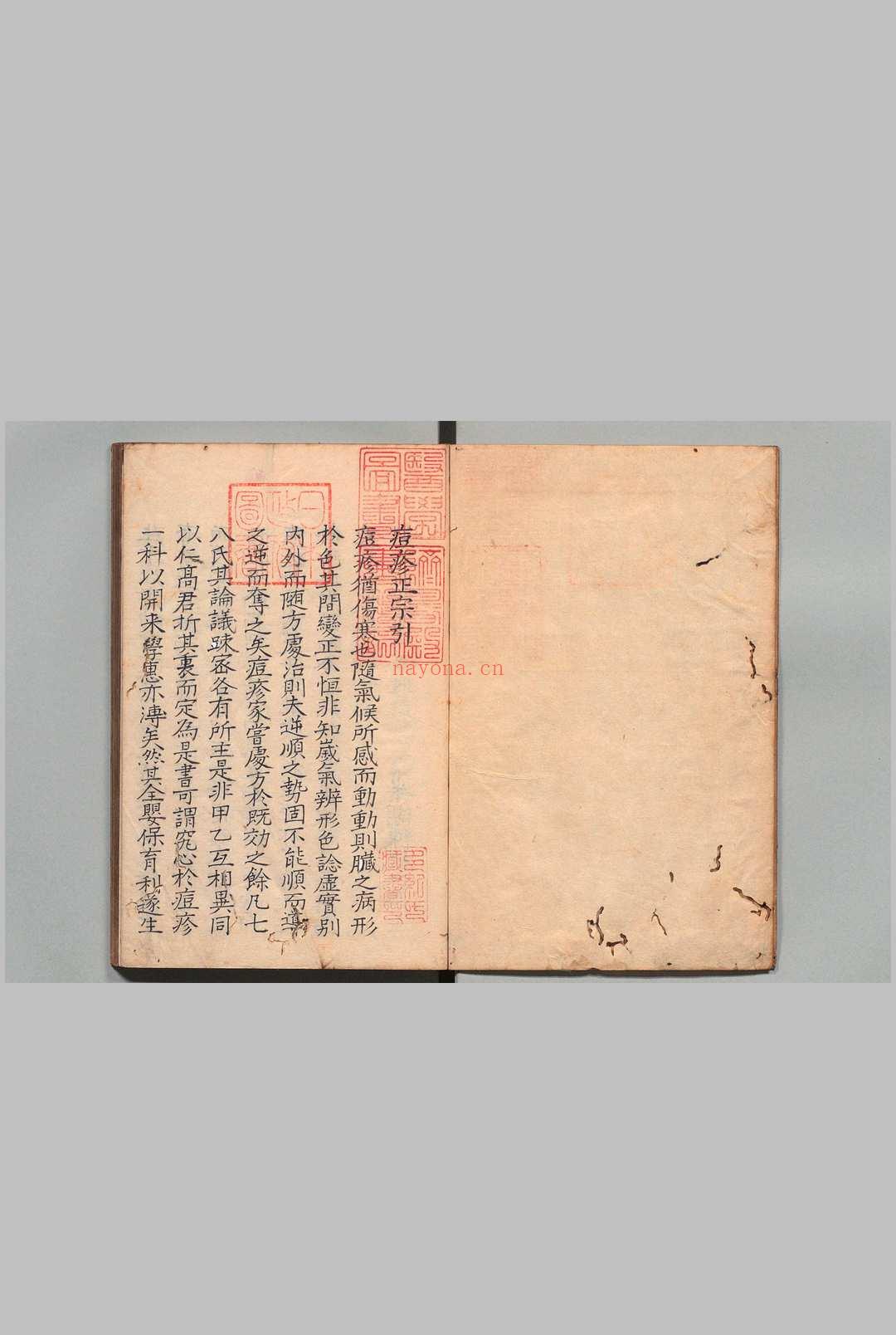 痘疹正宗 4卷 高武(明)写本 ,江户