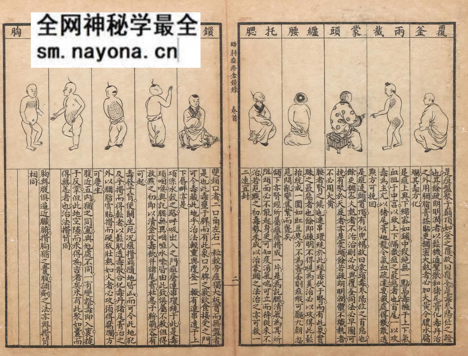 《幼科三种铁镜集症》9卷3种