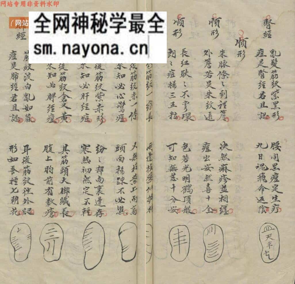 医宗金鉴[幼科种痘心法] 痘科耳纹