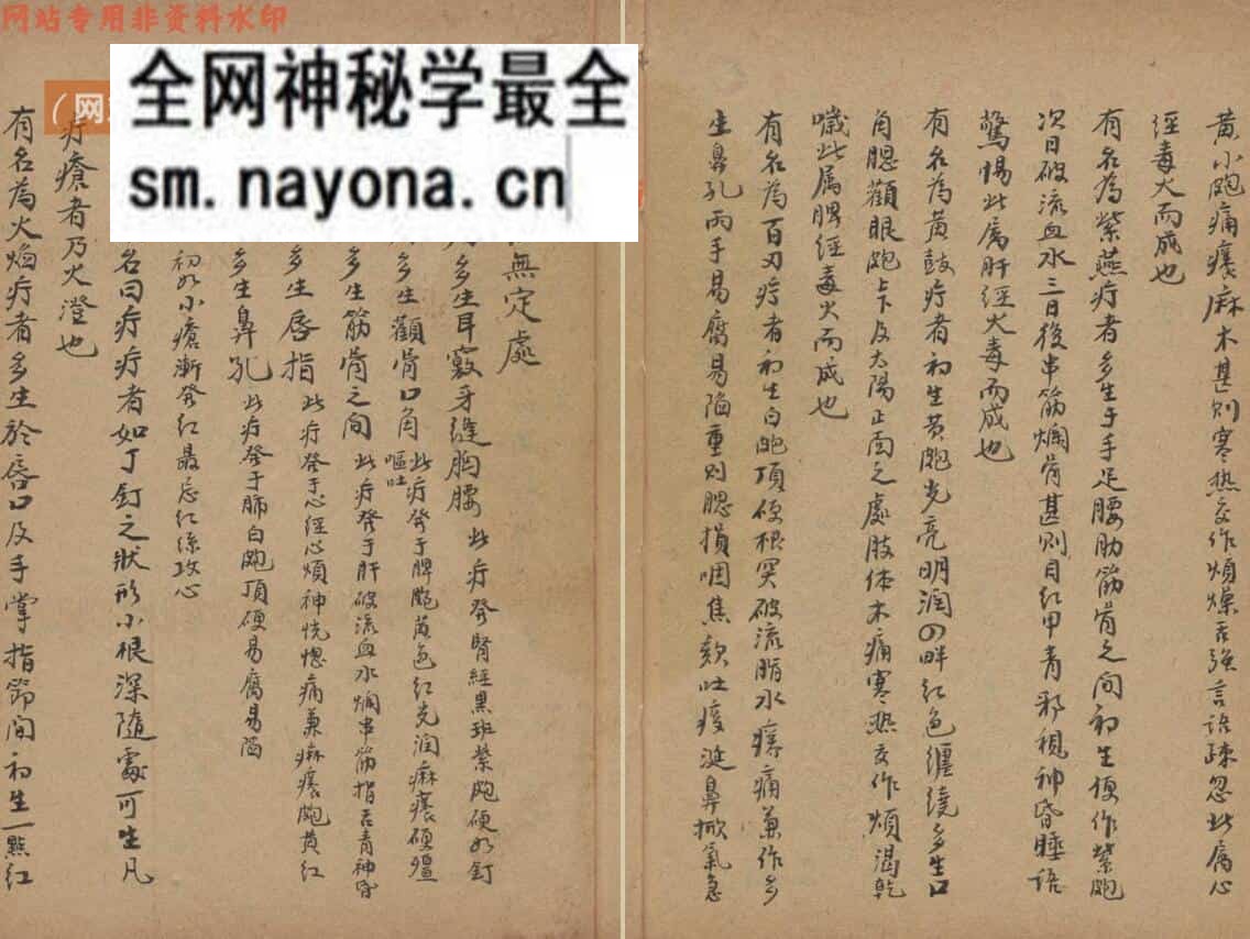 医宗金鉴.外科心法