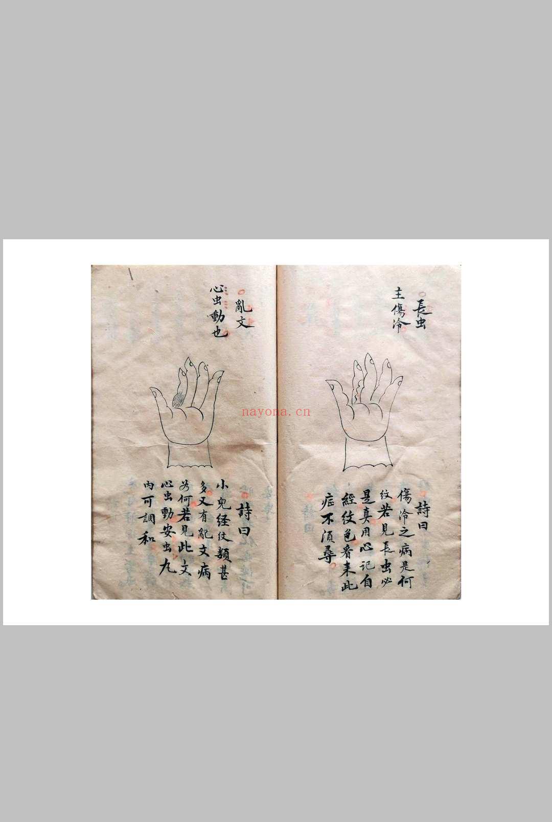 《祖传小儿科神火经纹秘诀》