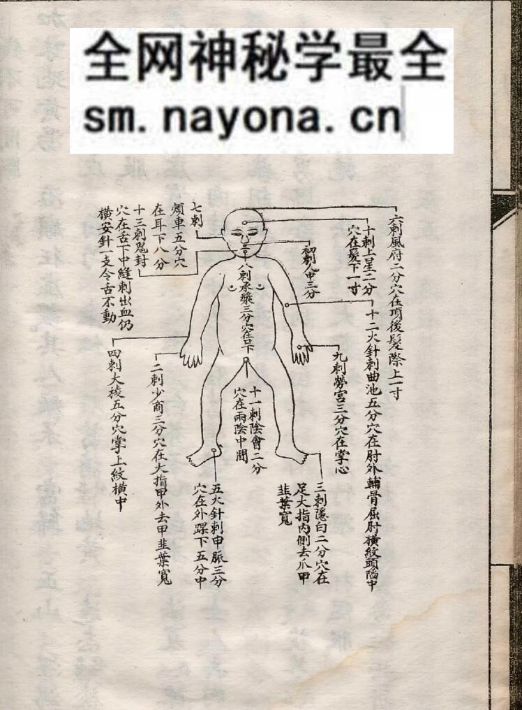《针砭宝筏》