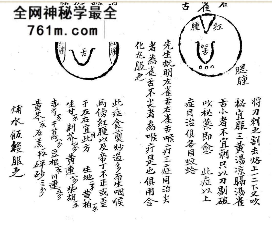 中医古籍《咽喉秘传》