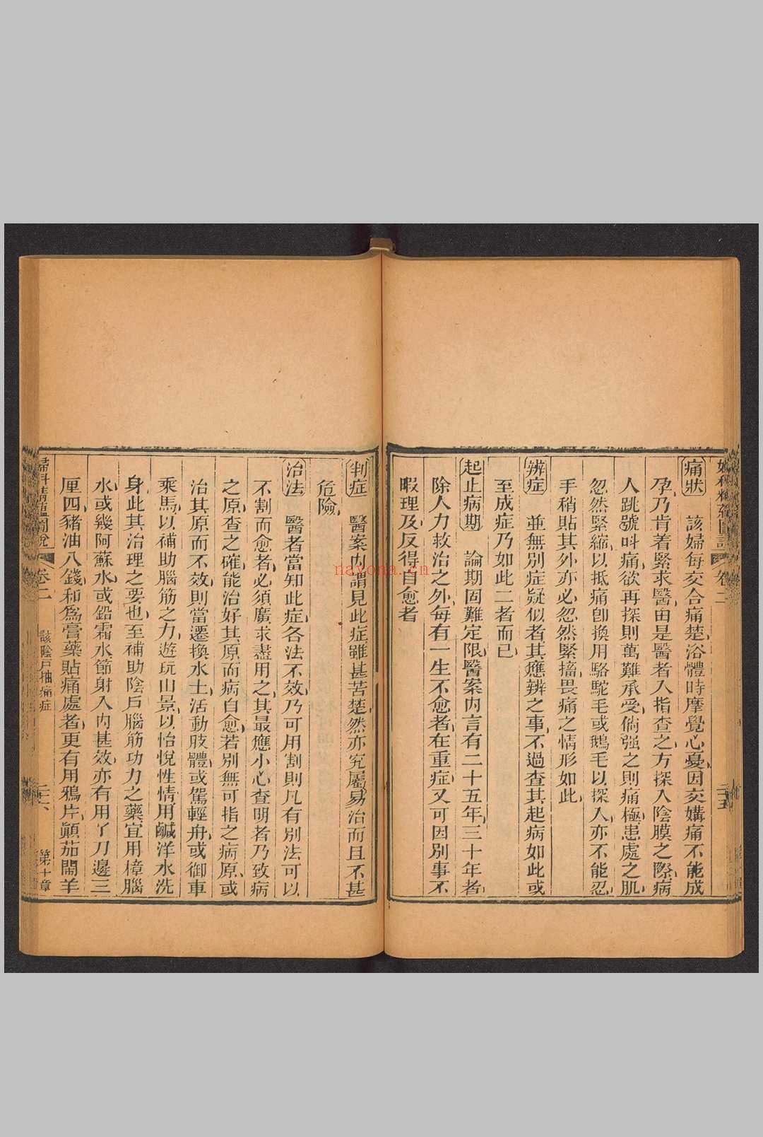 妇科精蕴图说 5卷 光绪15年(1889)羊城博济医局藏版