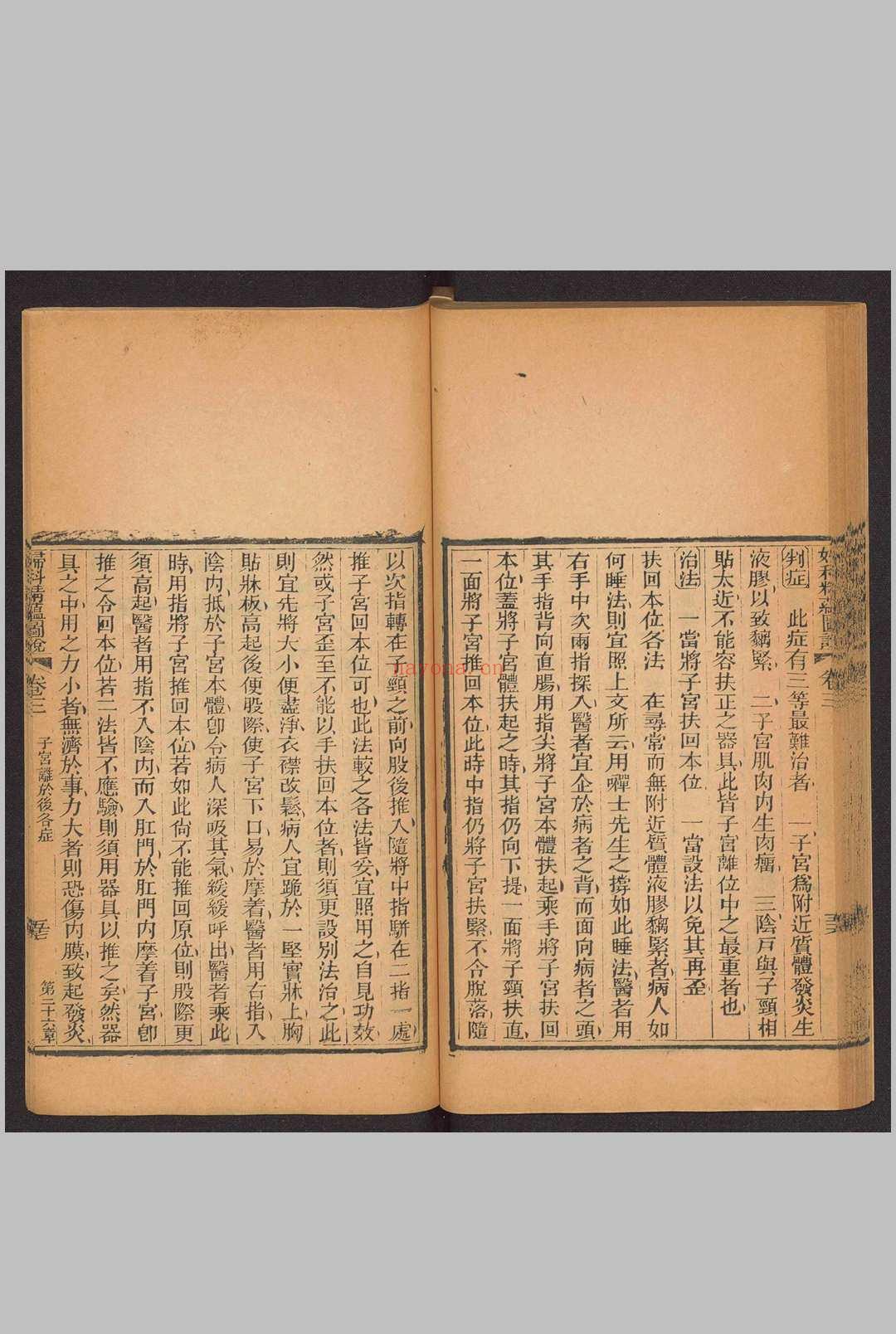 妇科精蕴图说 5卷 光绪15年(1889)羊城博济医局藏版