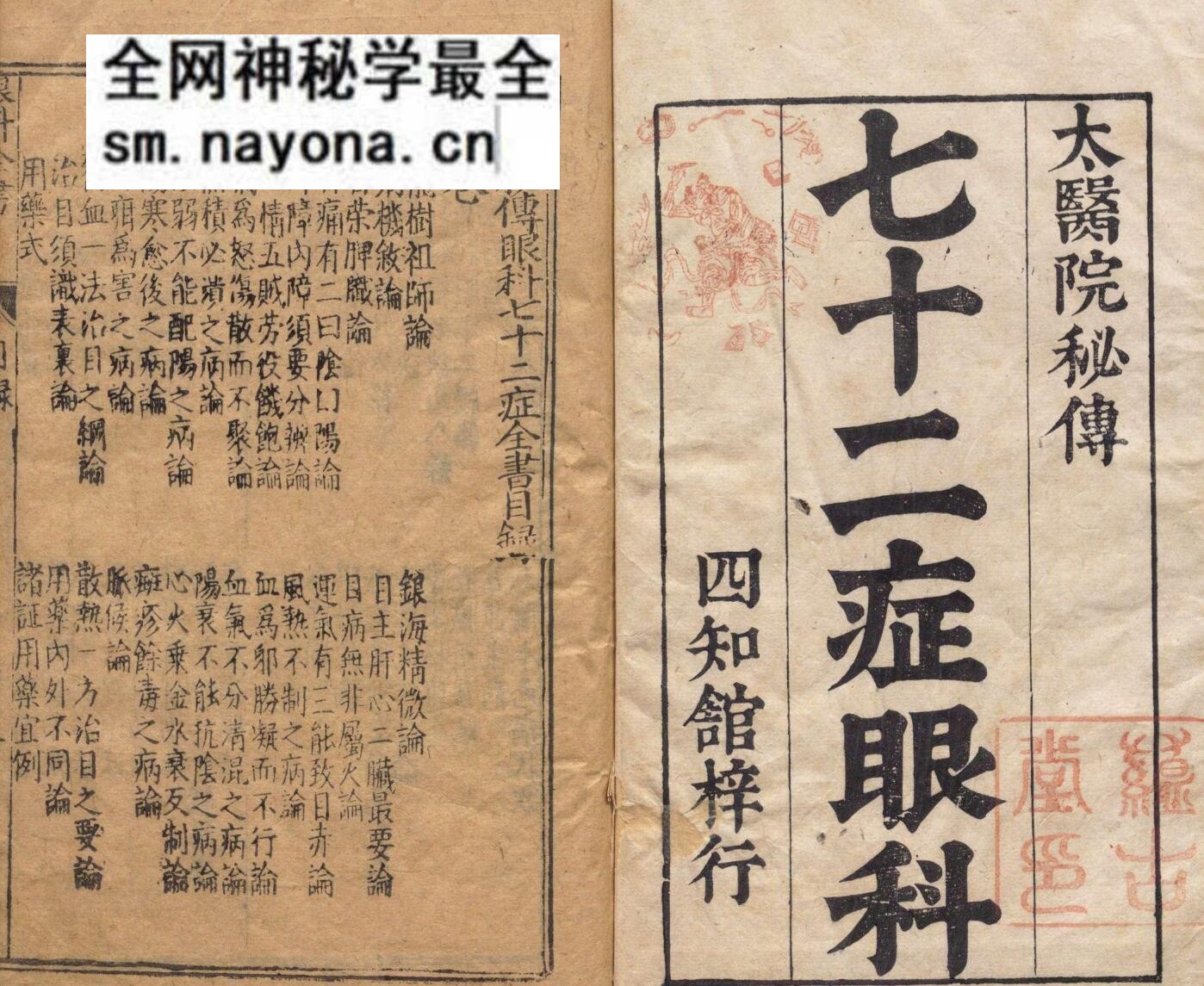 新刻秘传眼科七十二证全书 哀学渊 万历32年 杨泰斋