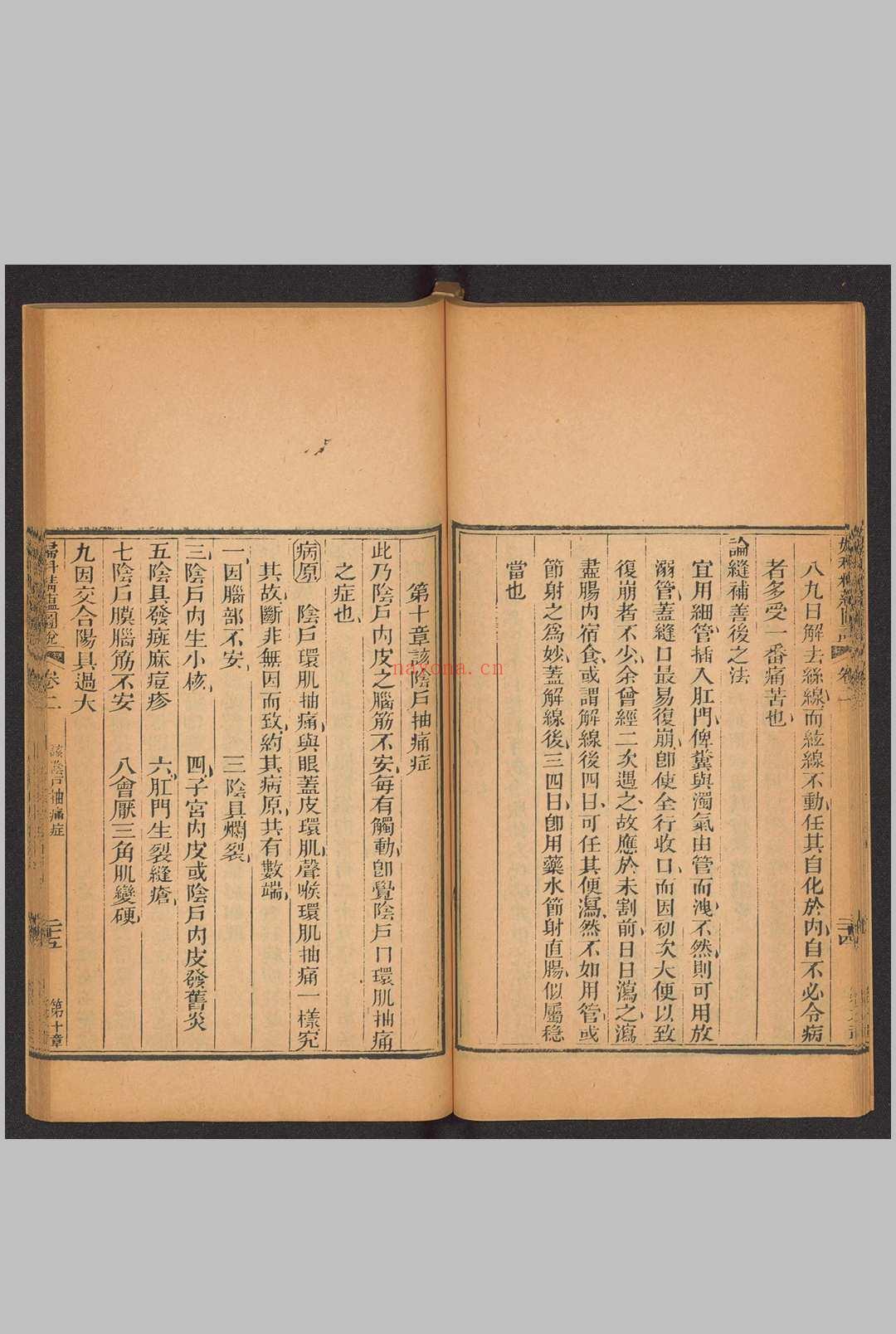 妇科精蕴图说 5卷 光绪15年(1889)羊城博济医局藏版