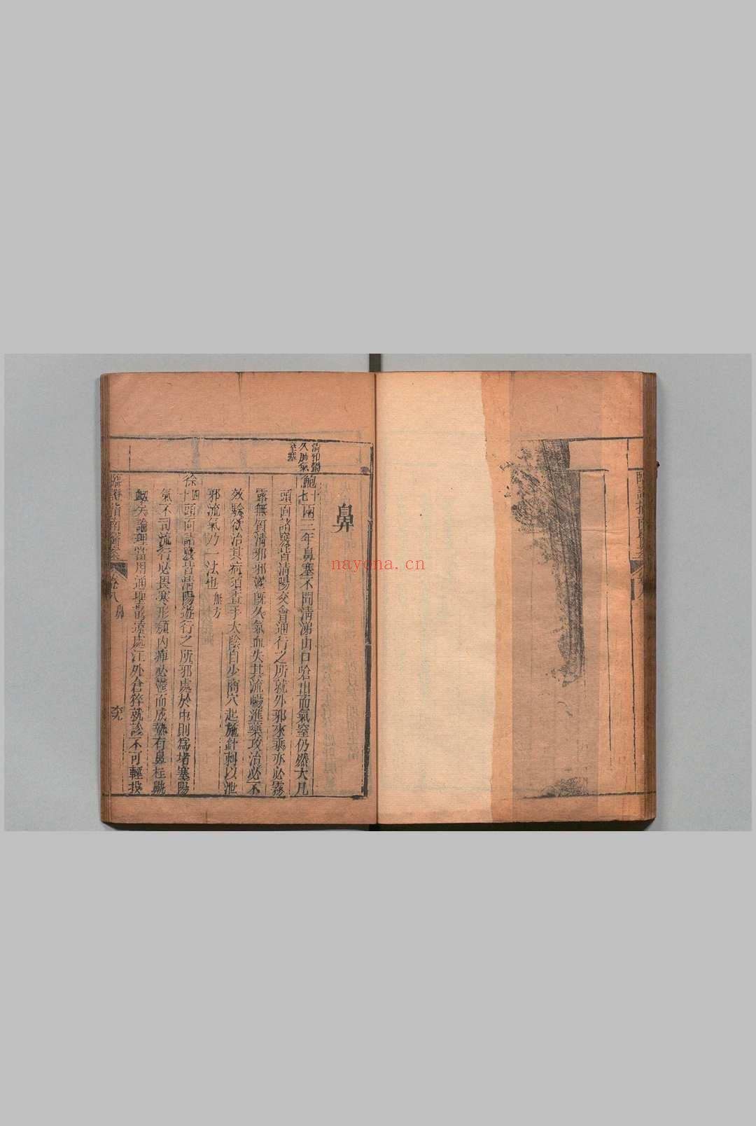 临证指南医案 10卷 欠卷6 叶桂,清乾隆33年