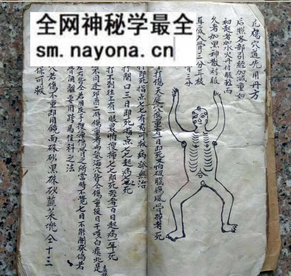 中医方书古籍《少林秘传跌打接骨奇方》
