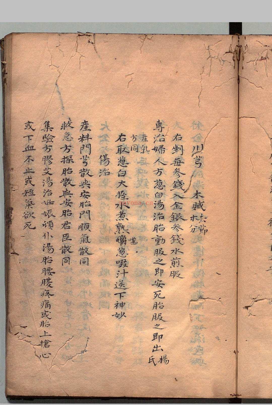 胎产救急方 李辰拱（元）写本 ,江户