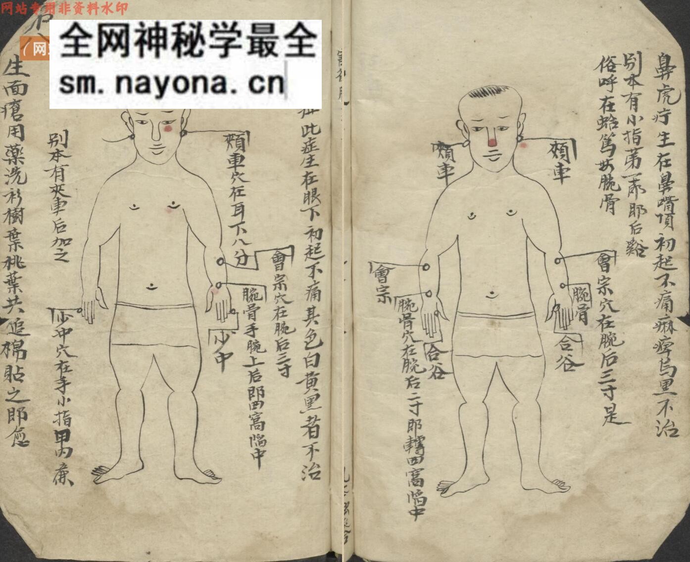 中医古籍《百症图说》