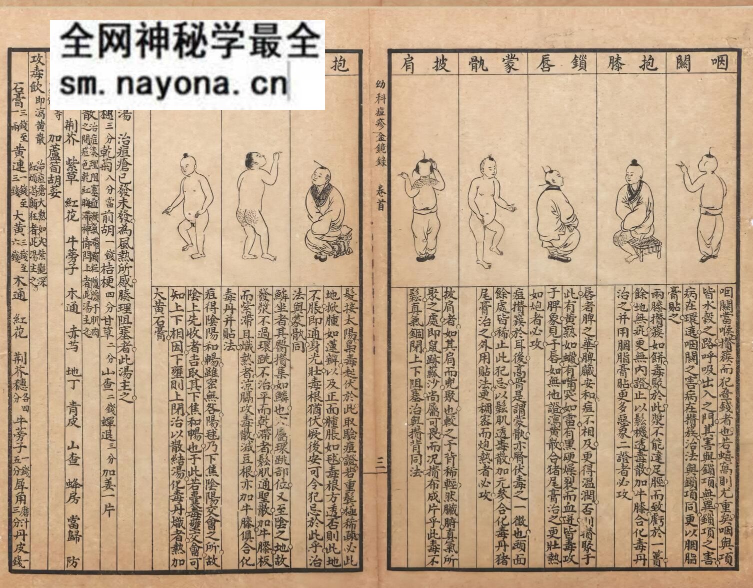 《幼科三种铁镜集症》9卷3种