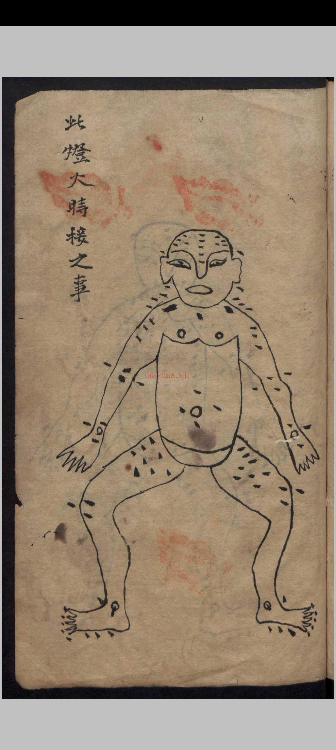 杂抄医书 , 1900
