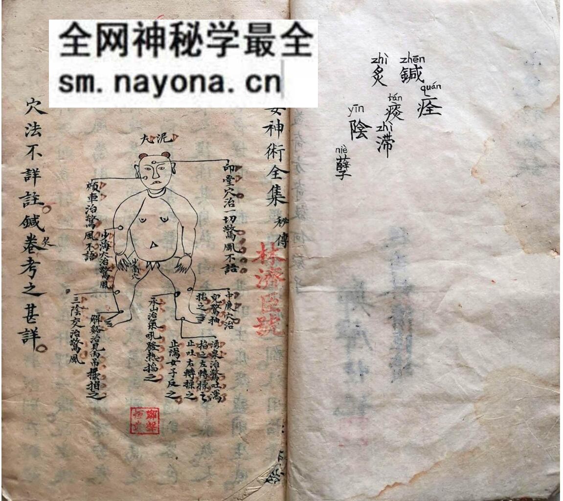 古籍《祖传小儿神火经纹秘诀》