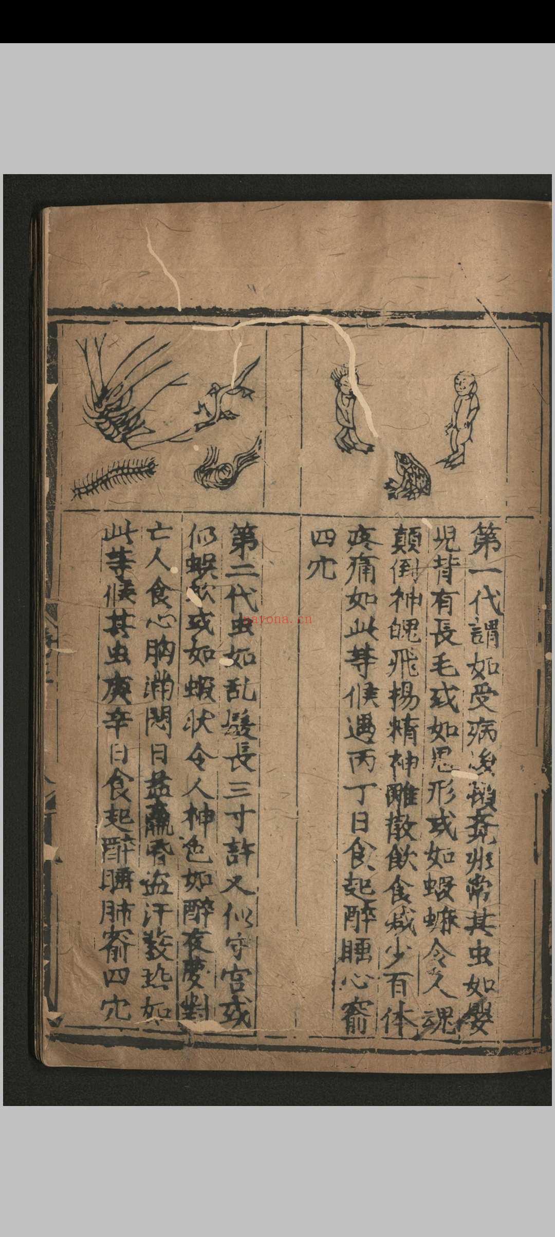 寿域神方.四卷 欠1-2卷.朱权