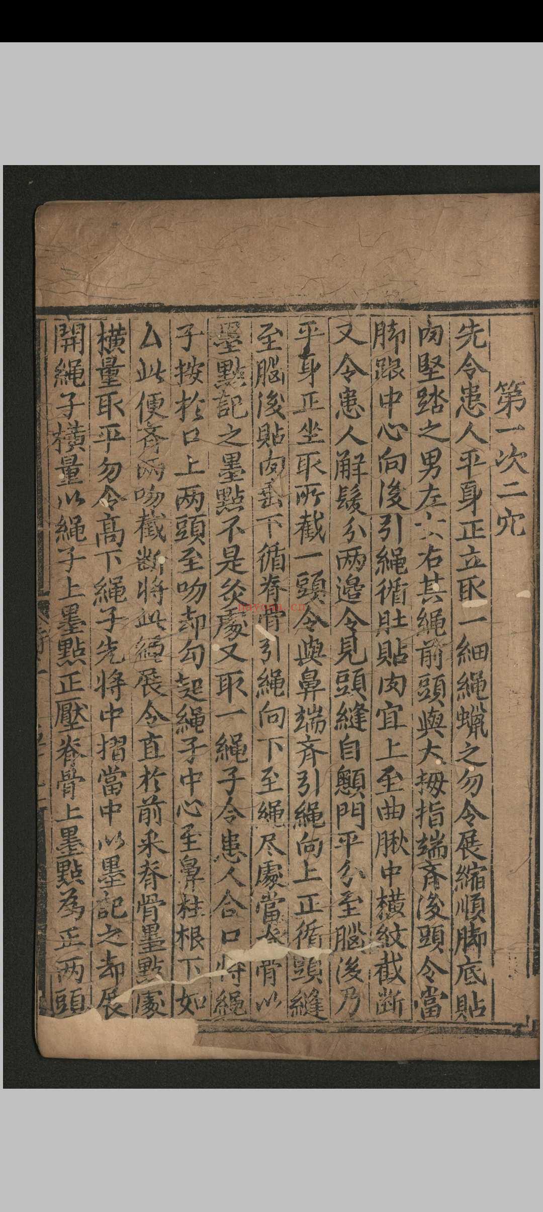 寿域神方.四卷 欠1-2卷.朱权