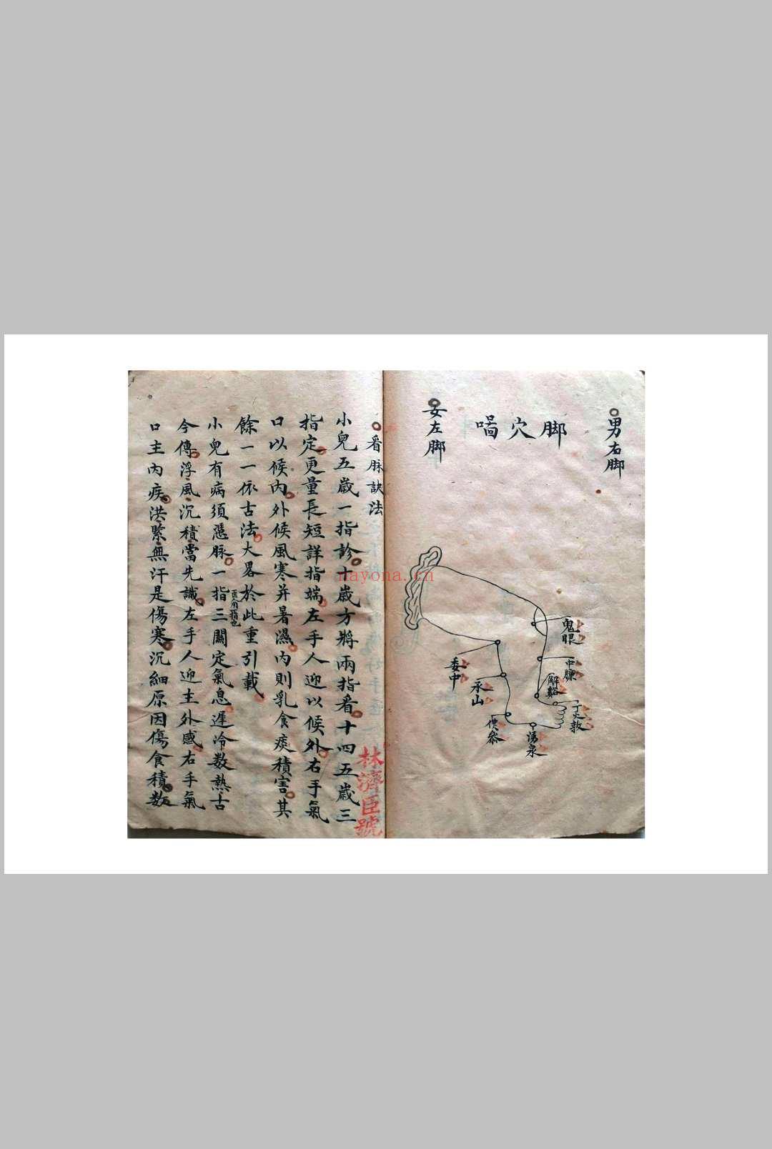 《祖传小儿科神火经纹秘诀》