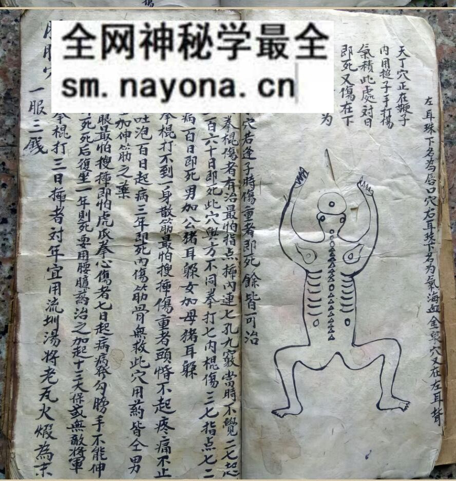中医方书古籍《少林秘传跌打接骨奇方》