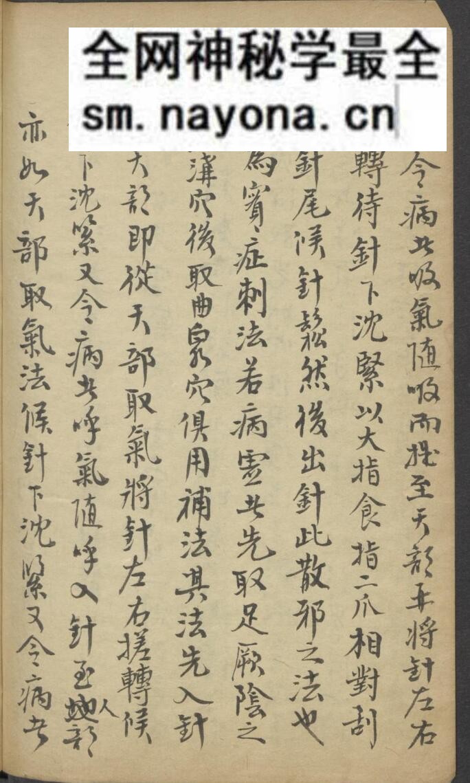 中医针灸古籍《亲验针灸汇录》