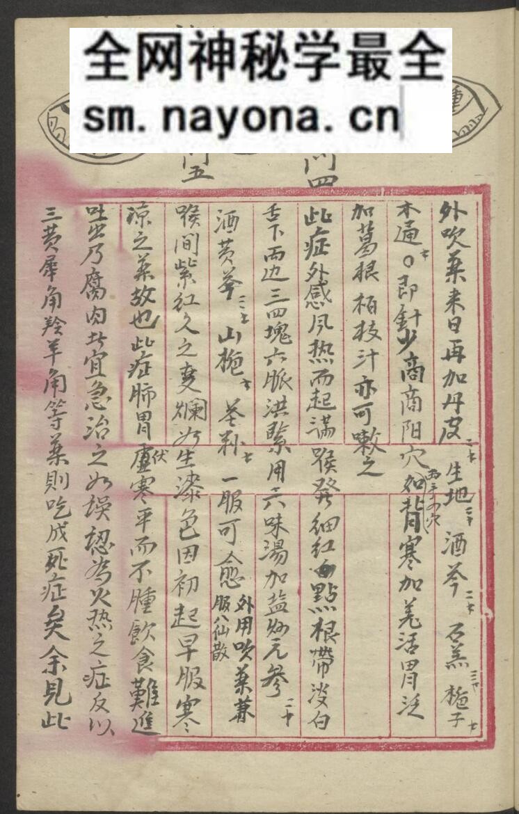 中医喉科古籍《喉科指掌大全》张宗良