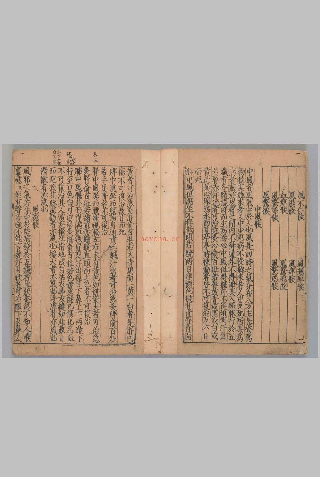 诸病源候论50卷.目1卷隋.巢元方撰.[宋末元初]刊([建])[修]