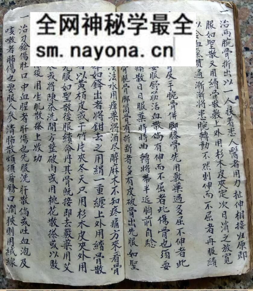 中医方书古籍《少林秘传跌打接骨奇方》